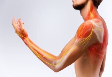 Điều trị viêm đa dây thần kinh theo đông và tây y